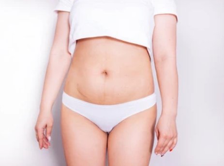 Lower Body Surgery